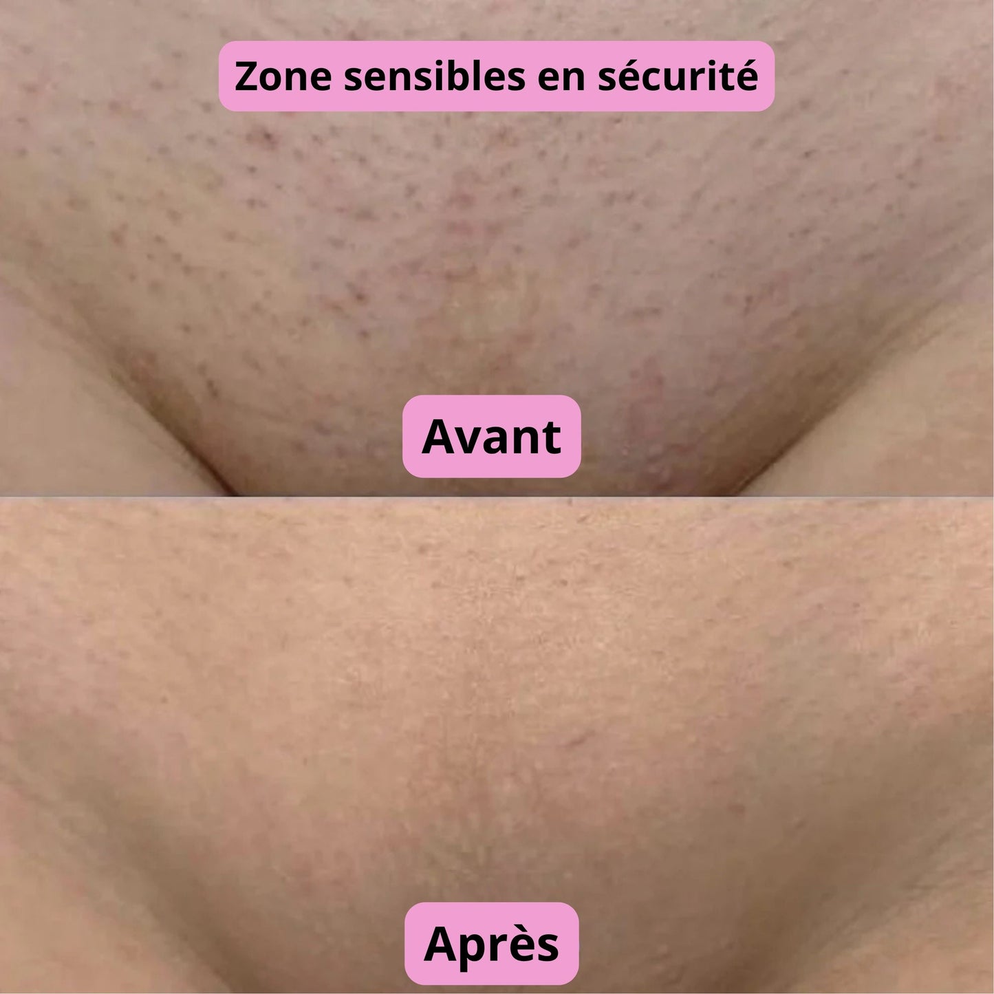 Rasoir 2-en-1 AVENA©