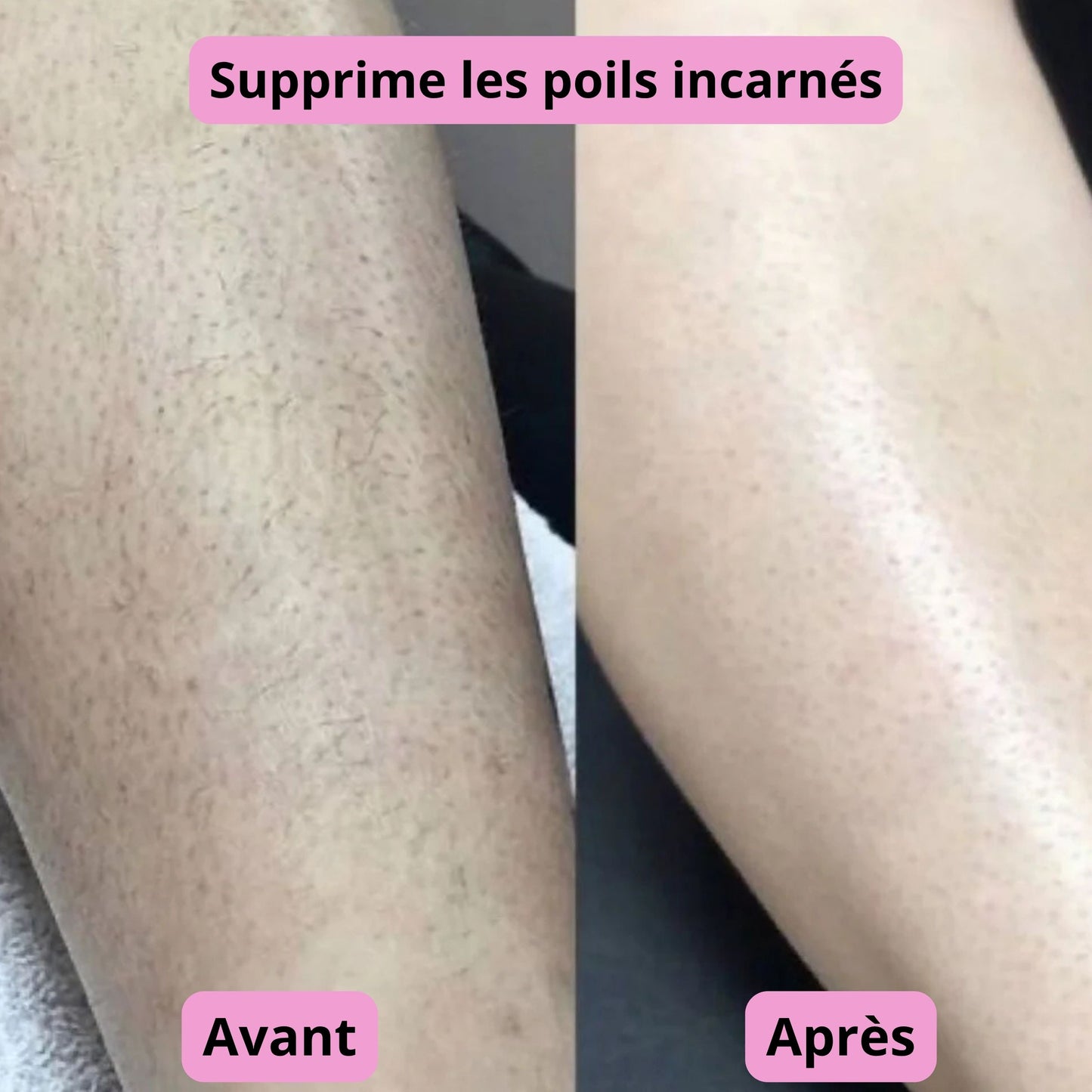 Rasoir 2-en-1 AVENA©